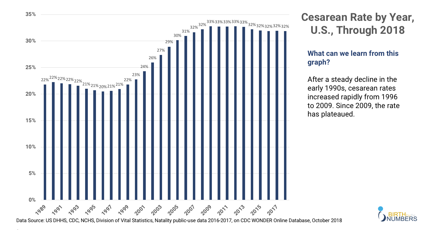 Cesarean Sections 