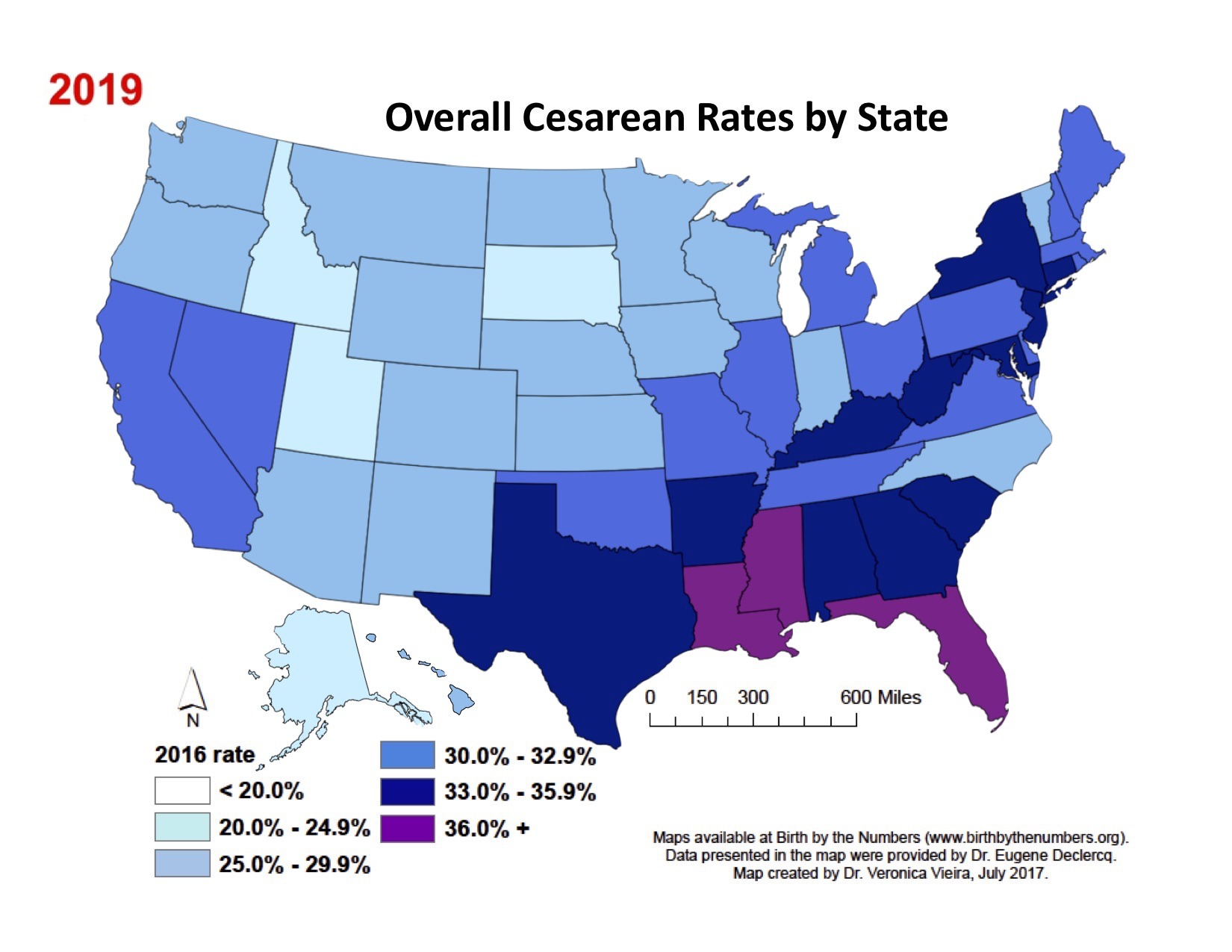 Cesarean Sections 